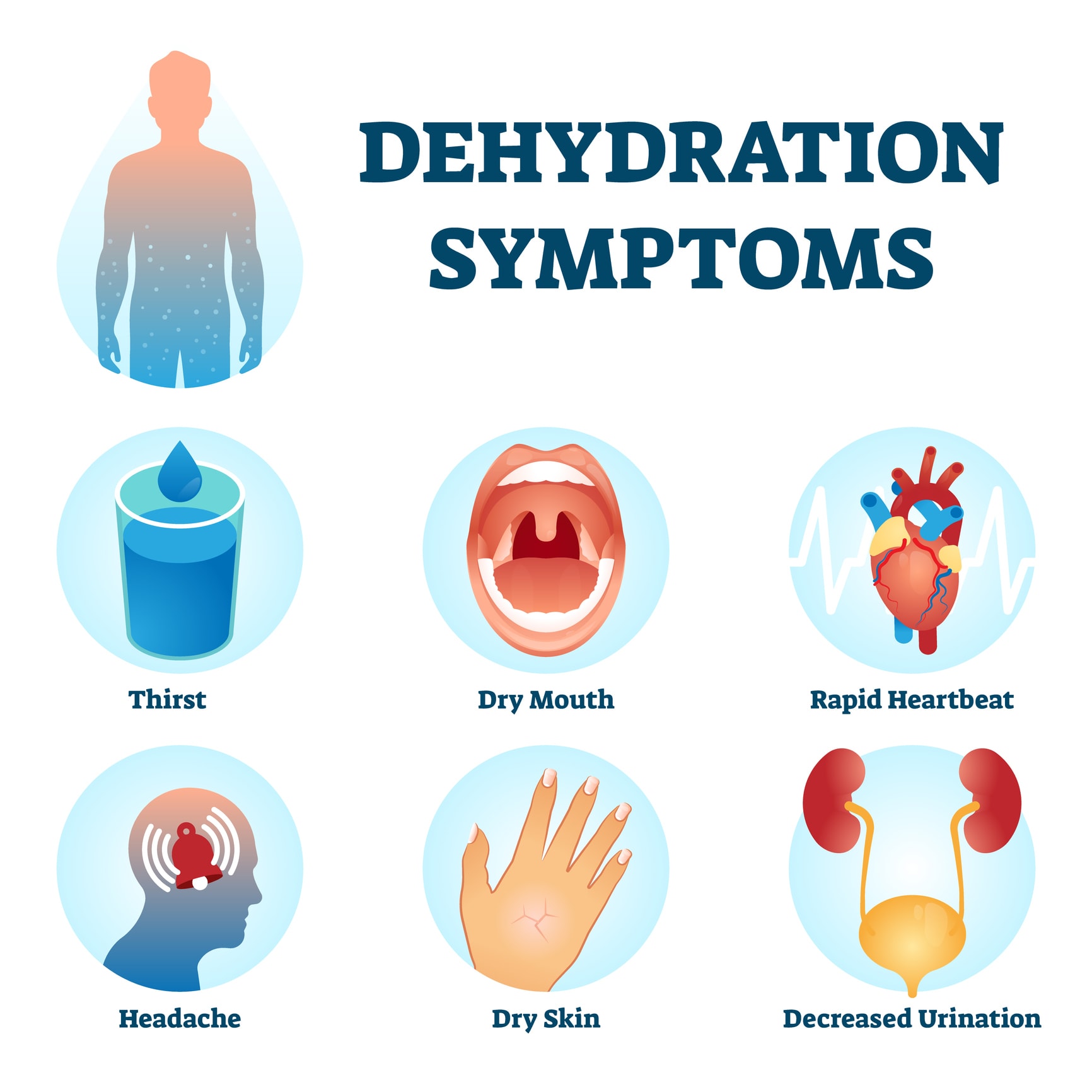 Misforståelse Ups værdighed Dehydration Pro Tips - AEC Living
